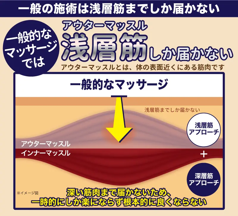 アウターマッスル